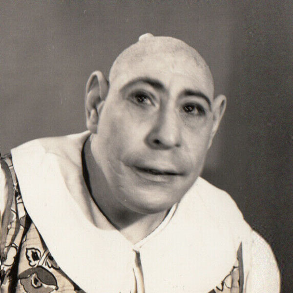 Schlitzie